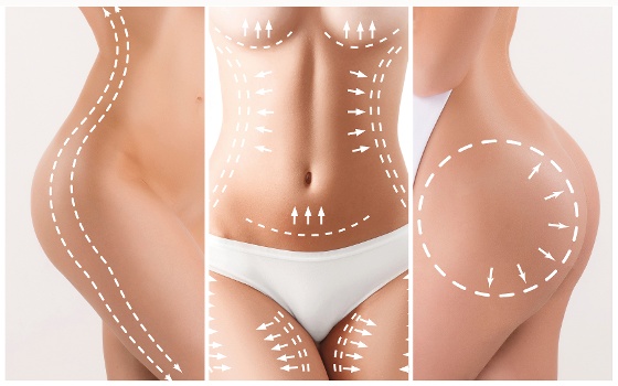 cellulite endermologie®