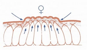 fonctionnement de la cellulite LPG