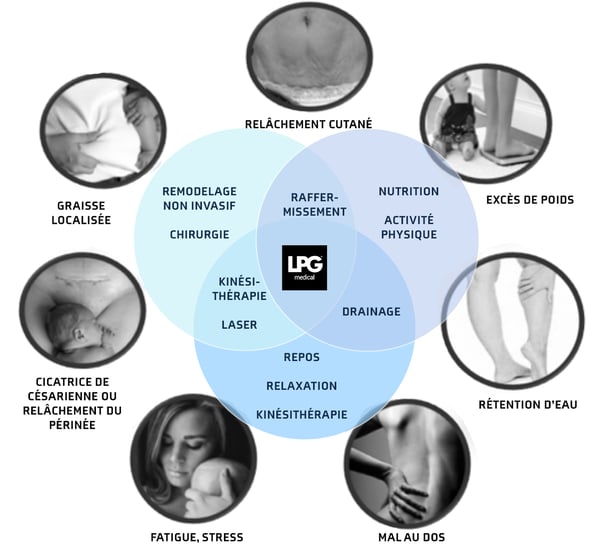 actions-reactions-poids-lpg