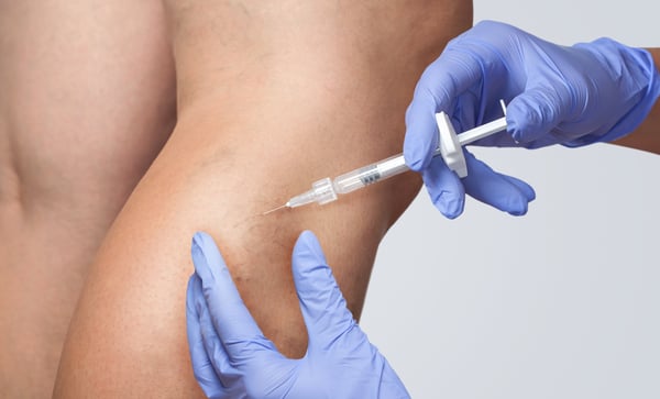 varices lpg endermologie