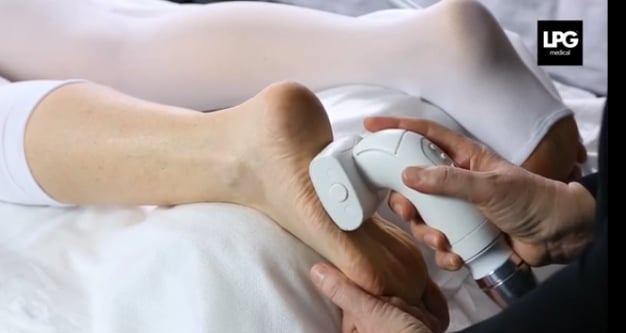lpg endermologie